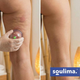 Kitajsko vakuumsko konzerviranje